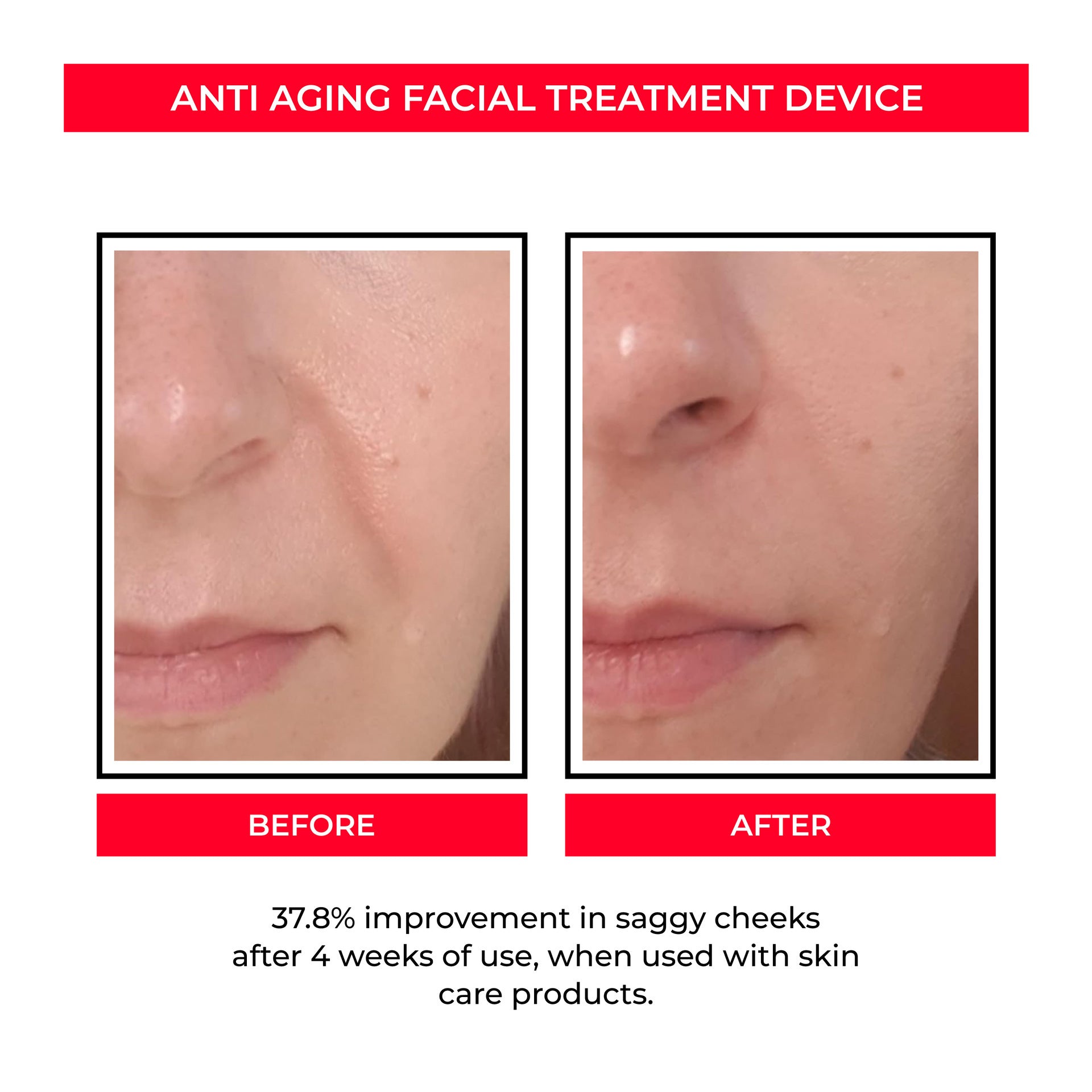 Beauty Instrument Pore Convergence EMS Skin Rejuvenation Micro Current - KKAM STORES